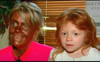 Patricia Krentcil tanned five days a week and almost lost her life – this is what “Tan Mom” looks like today