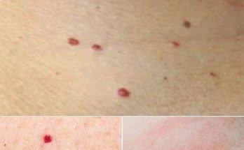 Red Dots on Your Skin: Causes and What They Could Mean