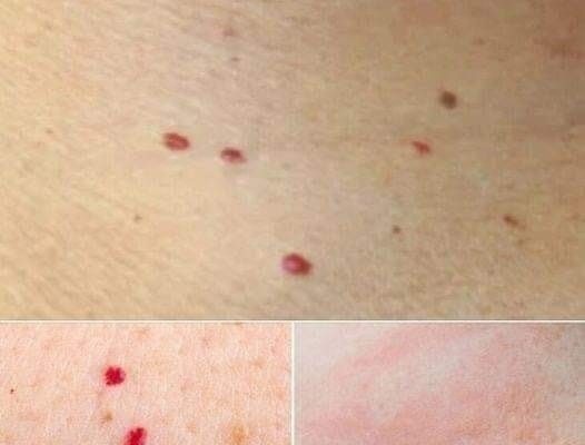 Red Dots on Your Skin: Causes and What They Could Mean